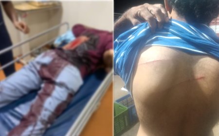 ಮಂಗಳೂರು | ಇಬ್ಬರು ಯುವಕರಿಗೆ ಚೂರಿ ಇರಿತ: ಆಸ್ಪತ್ರೆಗೆ ದಾಖಲು