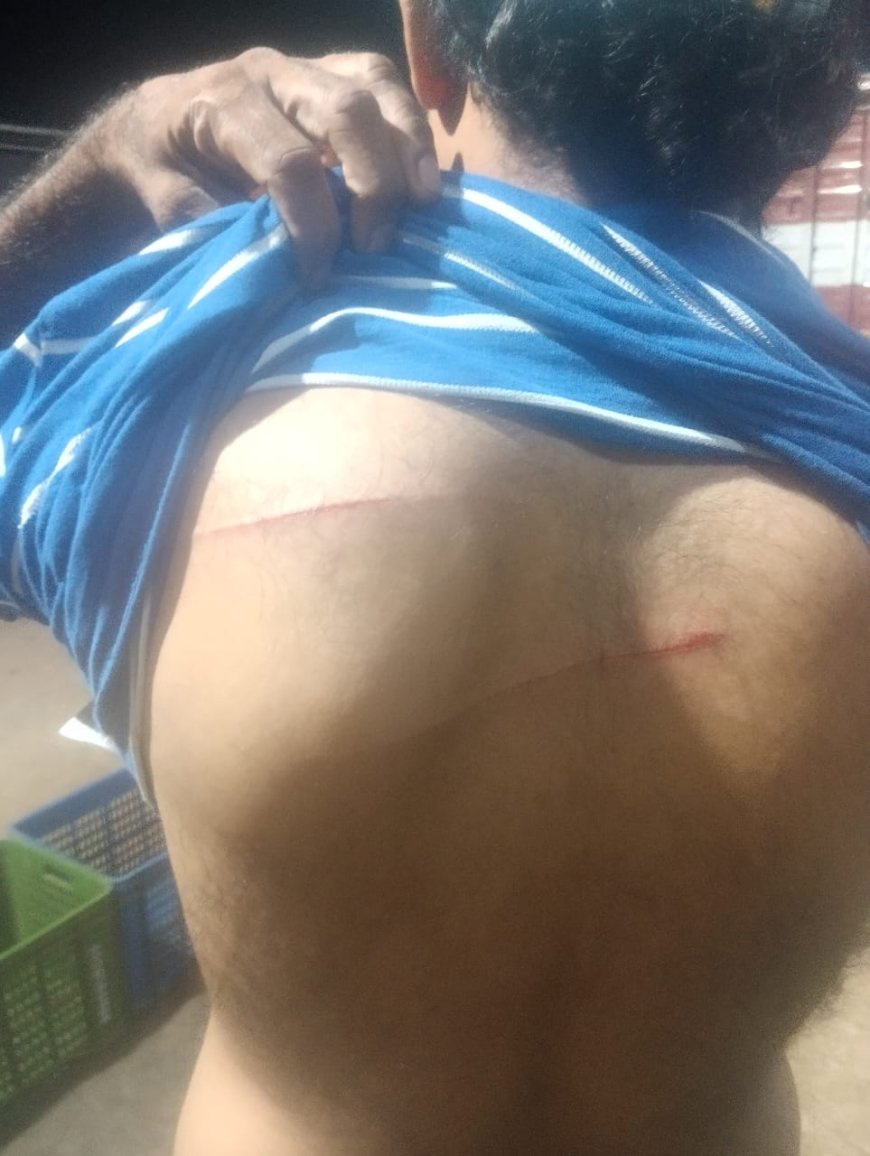 ಉಳ್ಳಾಲ: ತೊಕ್ಕೊಟ್ಟು ಒಳಪೇಟೆಯಲ್ಲಿ ಯುವಕನ ಮೇಲೆ ತಲವಾರಿನಿಂದ ದಾಳಿ