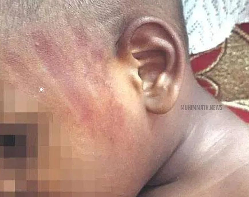 അങ്കണവാടിയിലെ രണ്ടര വയസുകാരിയുടെ മുഖത്തടിച്ച അധ്യാപികക്ക് സസ്‌പെന്‍ഷന്‍