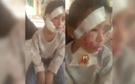 ಸ್ಥಳೀಯ ಆಡಳಿತದ ನಿರ್ಲಕ್ಷ್ಯ: ಅಂಗನವಾಡಿಗೆ ಹೋಗುವ ವೇಳೆ ಮಗುವಿನ ಮೇಲೆ ದಾಳಿ ಮಾಡಿದ ಬೀದಿ ನಾಯಿ