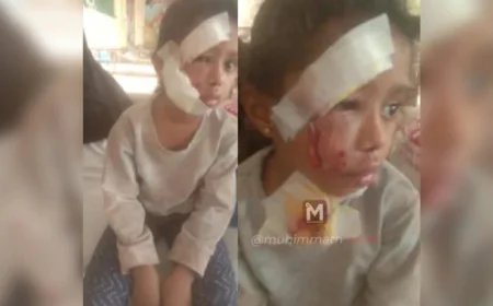 അങ്കണവാടിയിലേക്ക് പോകുന്നതിനിടെ തെരുവ് നായ ആക്രമണം; നാലു വയസ്സുകാരിക്ക് ഗുരുതര പരിക്ക്